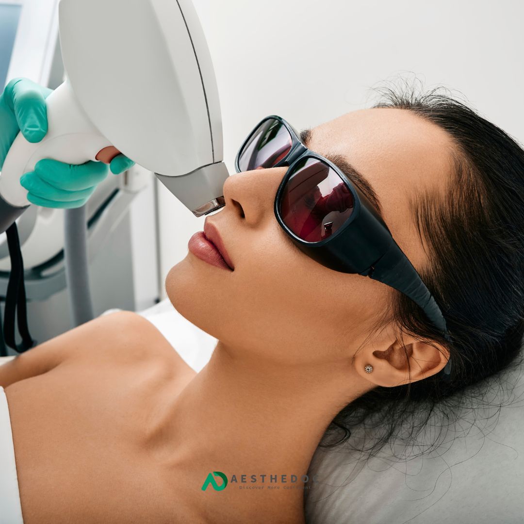 Face Laser Hair Removal in Rawalpindi