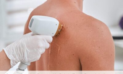Back Laser Hair Removal in Bahria Town Rawalpindi