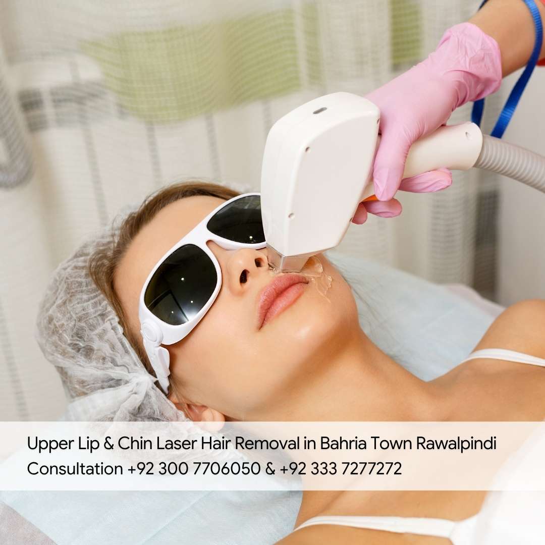 Upper Lip & Chin Laser Hair Removal in Bahria Town Rawalpindi